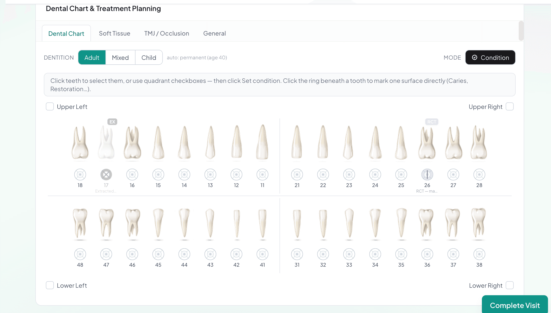 Interactive FDI dental chart with tooth conditions marked